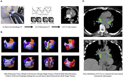 Paroxysmal Atrial Fibrillation in Elderly: Worldwide Preliminary Data of LINAC-Based Stereotactic Arrhythmia Radioablation Prospective Phase II Trial